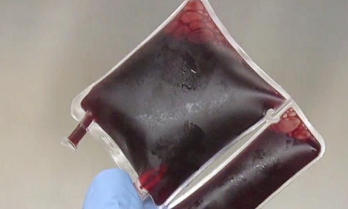 A gloved fingertip holds up a small medical bag of blood.