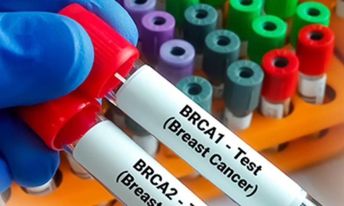 gloved fingers holding two test tubes, one labeled BRCA1 test breast cancer and the other labeled BRCA2 test breast cancer