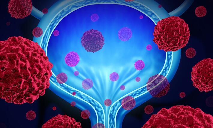 illustration of a bladder surrounded by cancer cells