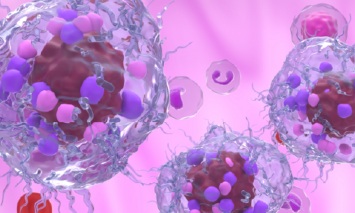 Metastatic neuroendocrine tumor cells in the blood flow