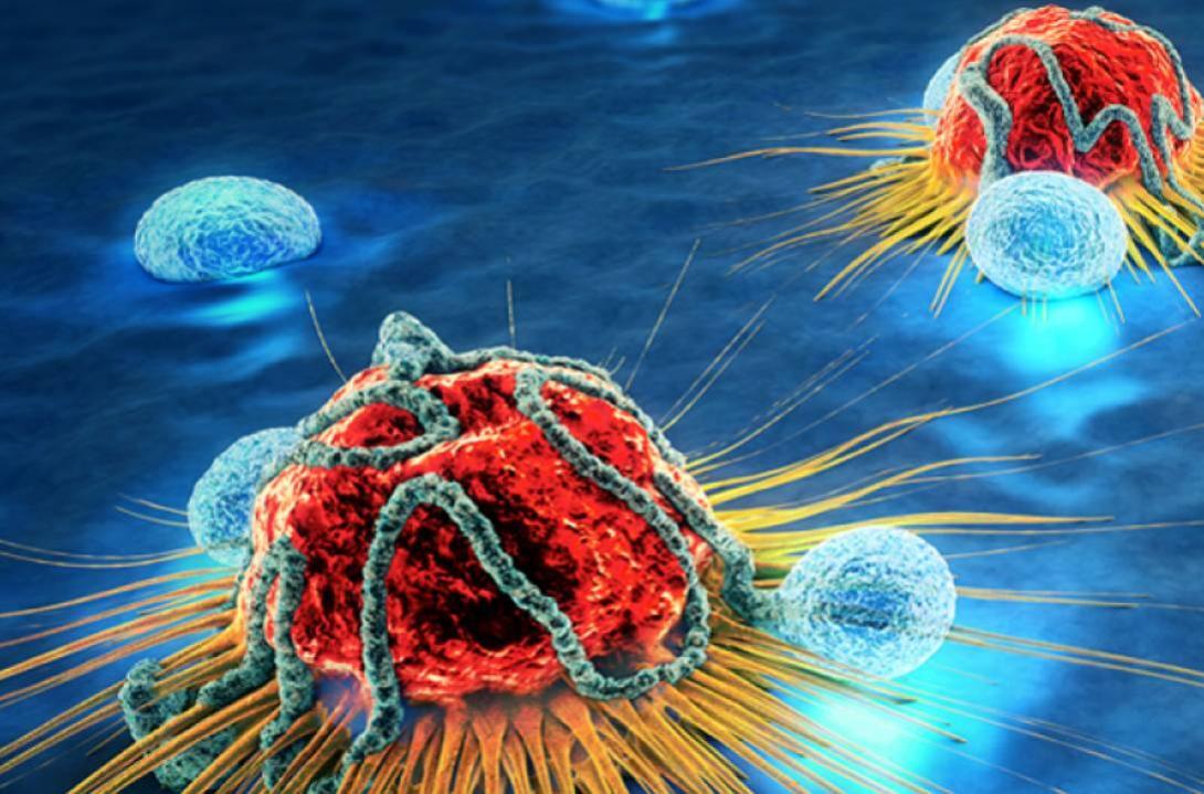 Cancer cells under a microscope