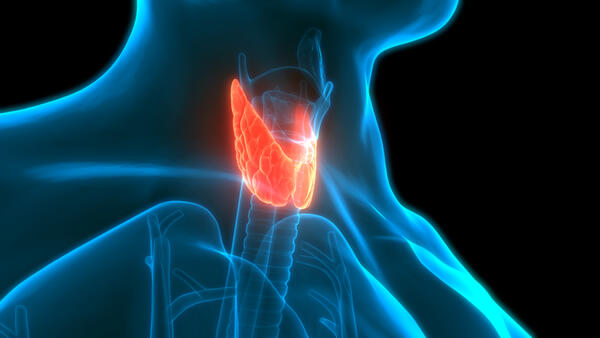 Thyroid cancer 3D rendering