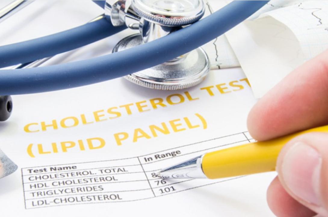 stethoscope, hand with pen pointing at cholesterol test lipid panel-labled chart